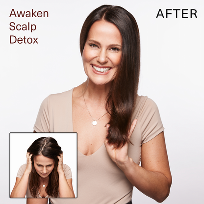 SUR AWAKEN SCALP DETOX 6oz