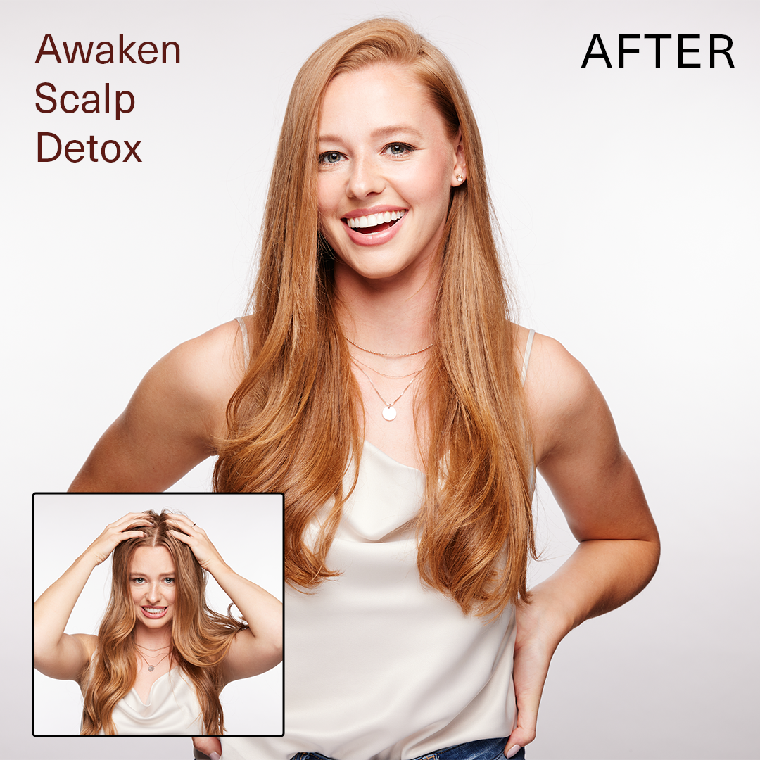 SUR AWAKEN SCALP DETOX 6oz