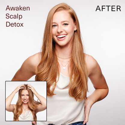 SUR AWAKEN SCALP DETOX 6oz