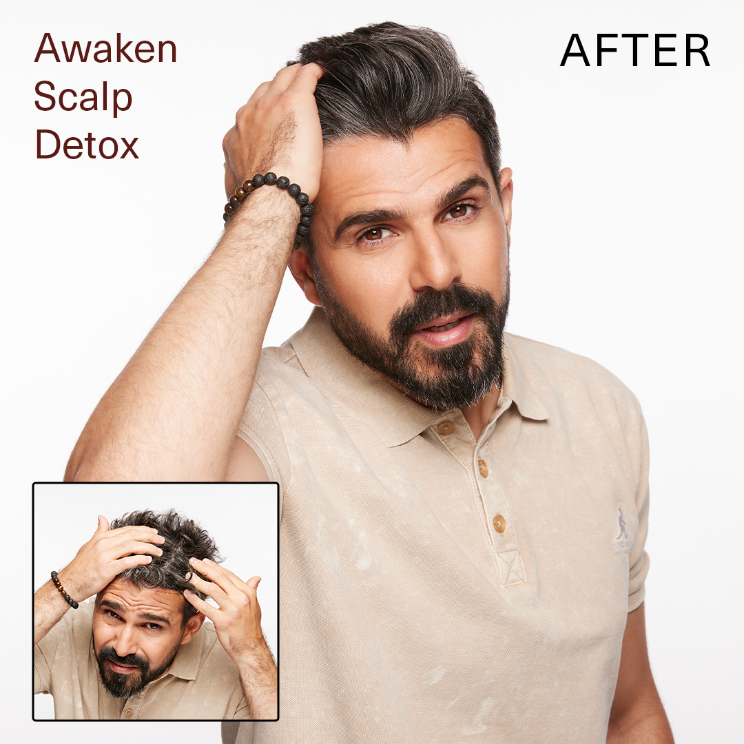 SUR AWAKEN SCALP DETOX 6oz