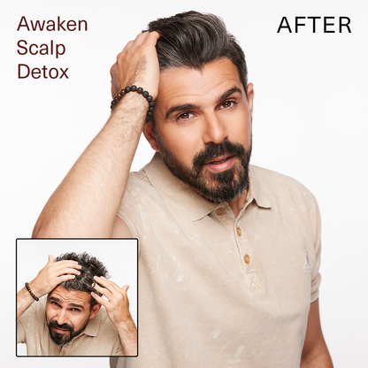 SUR AWAKEN SCALP DETOX 6oz